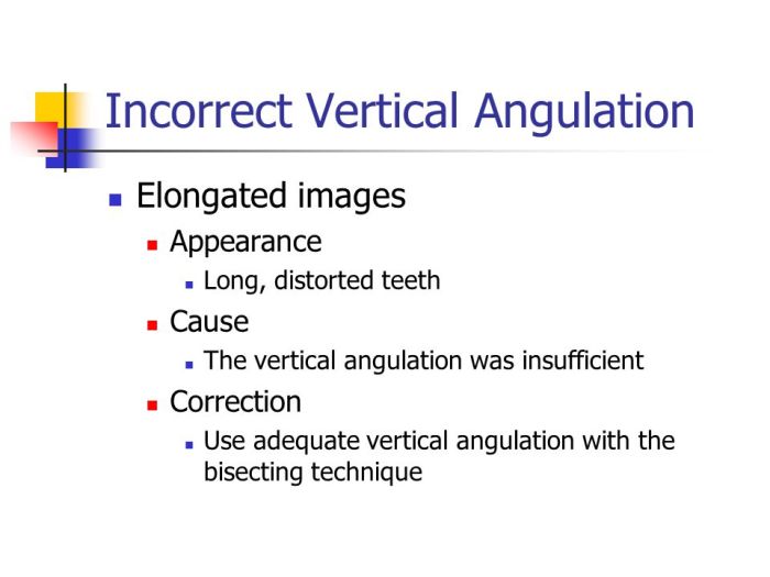 The result of incorrect vertical angulation