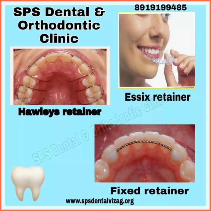 Retainers with springs to move teeth