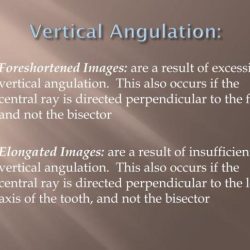 Dental bitewing rays premolar positioning tips